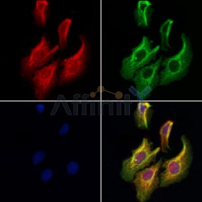 MYBPC1 Antibody - DF4198 staining Hela cells by IF/ICC.