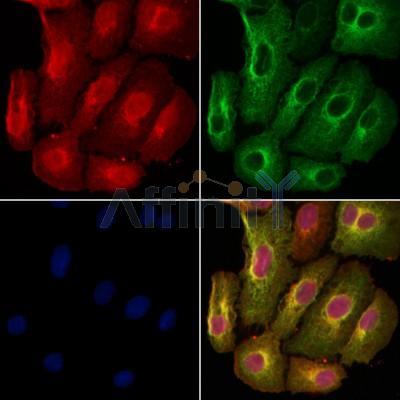 S100A16 Antibody - DF4353 staining Hela cells by IF/ICC.