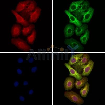 RABL2A Antibody - DF4374 staining Hela cells by IF/ICC.