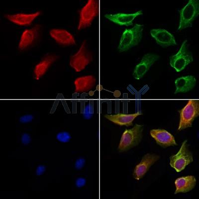SH3RF3 Antibody - DF4504 staining Hela cells by IF/ICC.