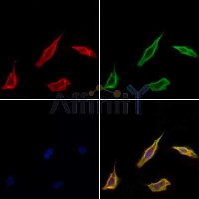 SHC2 Antibody - DF4506 staining Hela cells by IF/ICC.