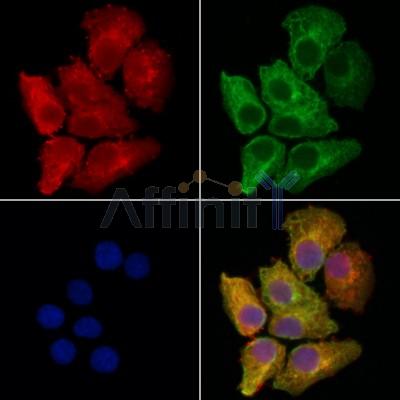 USP19 Antibody - DF4589 staining Hela cells by IF/ICC.