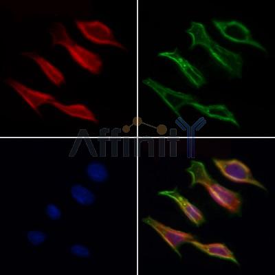 CG028 Antibody - DF4915 staining Hela cells by IF/ICC.