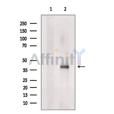 TMEM185A Antibody - Western blot analysis of extracts from COS-7, using TMEM185A Antibody.