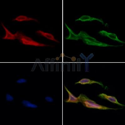ARPC1A Antibody - DF6215 staining Hela cells by IF/ICC.