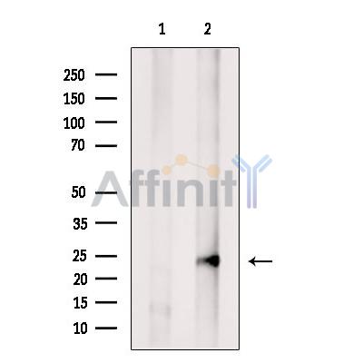 CRADD Antibody - Western blot analysis of extracts from Mouse  testis, using CRADD Antibody.