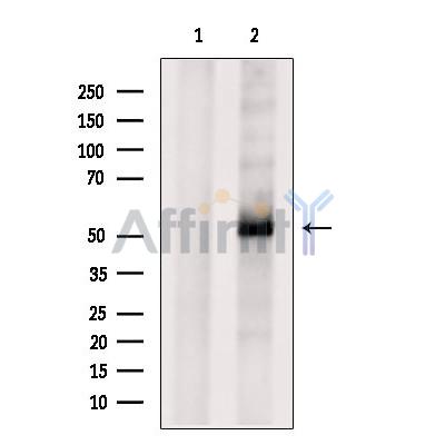 ATP6AP1 Antibody - Western blot analysis of extracts from MCF7, using ATP6AP1 Antibody.