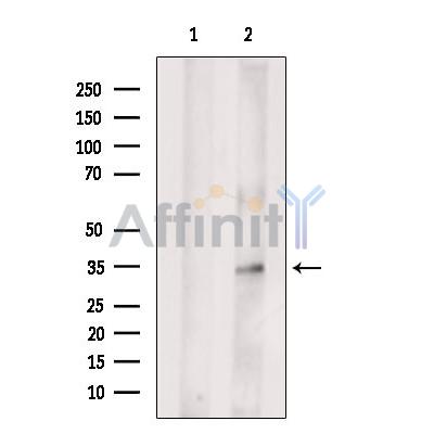 GIPC2 Antibody - Western blot analysis of extracts from Myeloma cells, using GIPC2 Antibody.