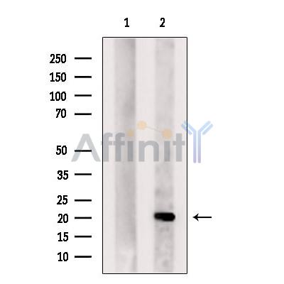 DHFR Antibody - Western blot analysis of extracts from VERO cells, using DHFR Antibody.