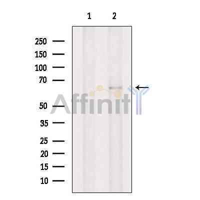 TAP2 Antibody - Western blot analysis of extracts from B16F10 cells, using TAP2  Antibody.