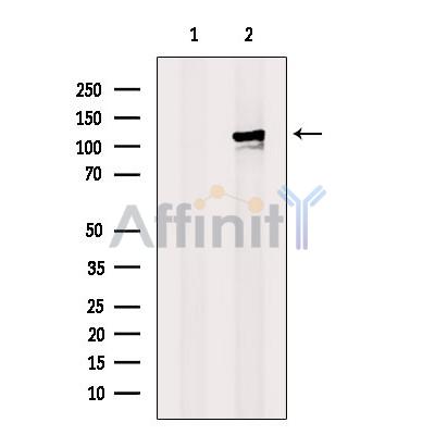 MCM6 Antibody - Western blot analysis of extracts from Rat  brain, using MCM6 Antibody.