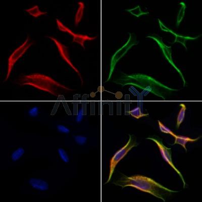 DST Antibody - DF6752 staining Hela cells by IF/ICC.