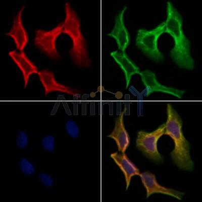 TPSAB1 Antibody - DF6758 staining Hela cells by IF/ICC.
