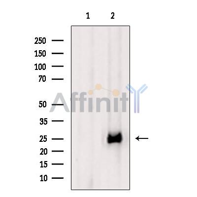 CTLA4 Antibody - Western blot analysis of extracts from Mouse  brain, using CTLA4 Antibody.