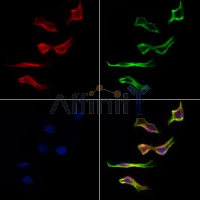 KBTBD3 Antibody - DF6875 staining Hela cells by IF/ICC.