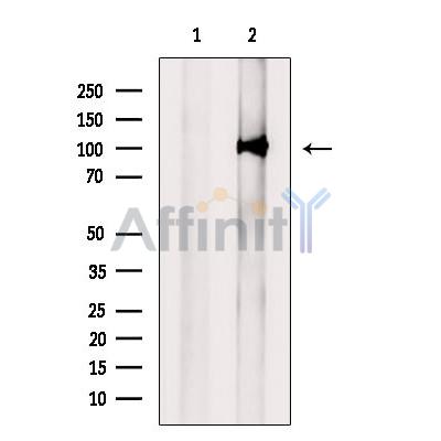 UHRF2 Antibody - Western blot analysis of extracts from Mouse  brain, using UHRF2  Antibody.