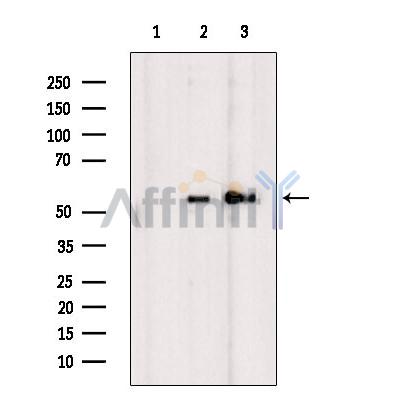 DKK3 Antibody - Western blot analysis of extracts from various samples, using DKK3 Antibody.