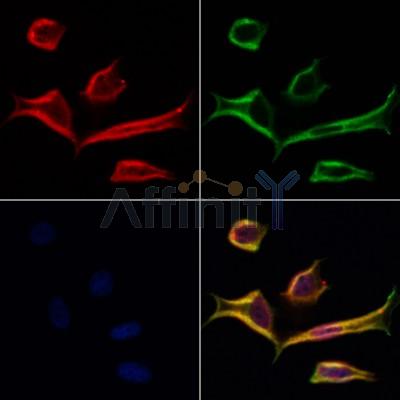 PCBP2 Antibody - DF6991 staining Hela cells by IF/ICC.