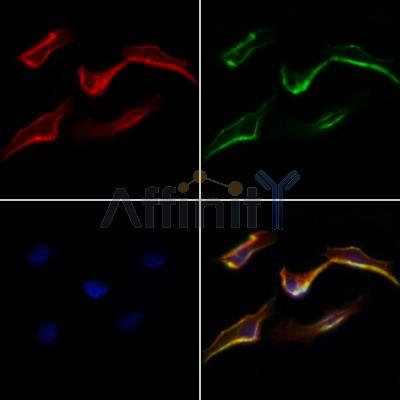 TRAP1 Antibody - DF7073 staining Hela cells by IF/ICC.