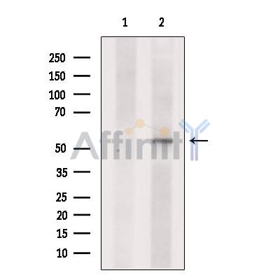 SLC16A4 Antibody - Western blot analysis of extracts from Mouse  brain, using SLC16A4  Antibody.