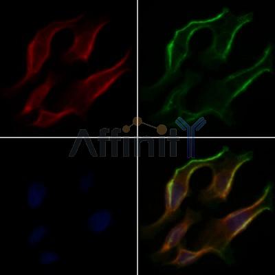 PDK4 Antibody - DF7169 staining Hela cells by IF/ICC.