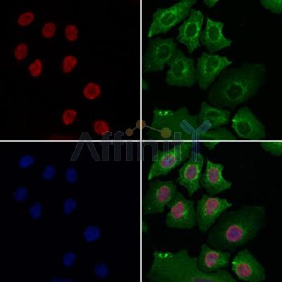 PARP1 Antibody - DF7198 staining Hela cells by IF/ICC.