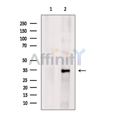 Calponin Antibody - Western blot analysis of extracts from Mouse  liver, using CNN1 Antibody.