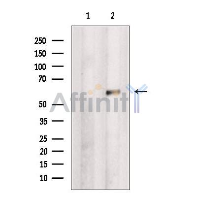 Sall4 Antibody - Western blot analysis of extracts from MCF7, using Sall4 Antibody.
