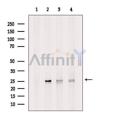 AGR2 Antibody - Western blot analysis of extracts from various samples, using AGR2 Antibody.