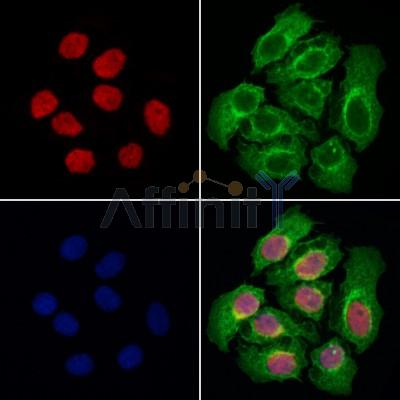 POU2AF1 Antibody - DF7859 staining Hela cells by IF/ICC.