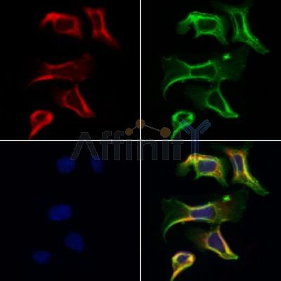 GnRH I Antibody - DF8553 staining Hela cells by IF/ICC.