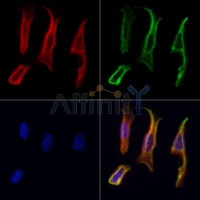 RBMS3 Antibody - DF8599 staining Hela cells by IF/ICC.