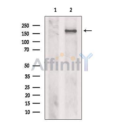 Tensin-1 Antibody - Western blot analysis of extracts from B16F10 cells, using Tensin-1 Antibody.
