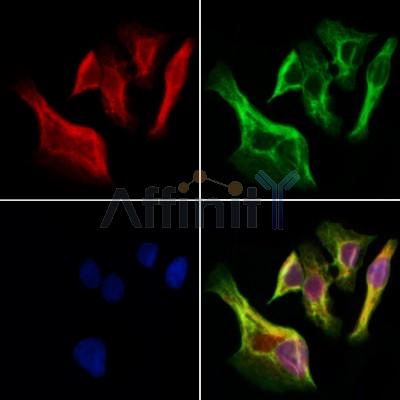 UCP2 Antibody - DF8626 staining Hela cells by IF/ICC.