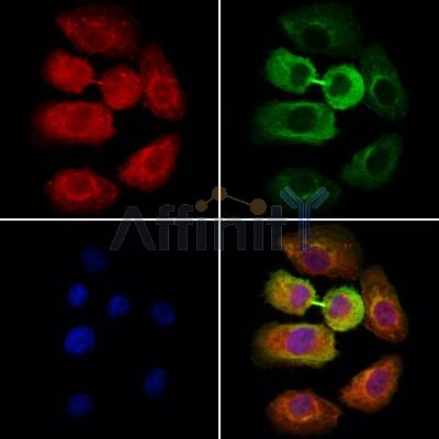 RMP Antibody - DF8716 staining Hela cells by IF/ICC.