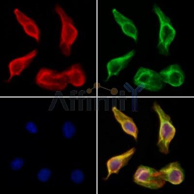 SLC30A8 Antibody - DF8719 staining Hela cells by IF/ICC.