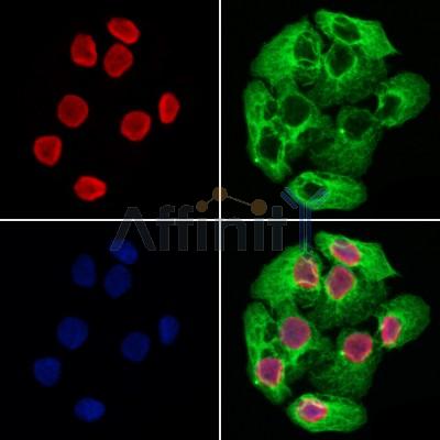 SOX12 Antibody - DF8757 staining Hela cells by IF/ICC.