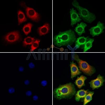 KITH_VZV7 Antibody - DF8788 staining Hela cells by IF/ICC.