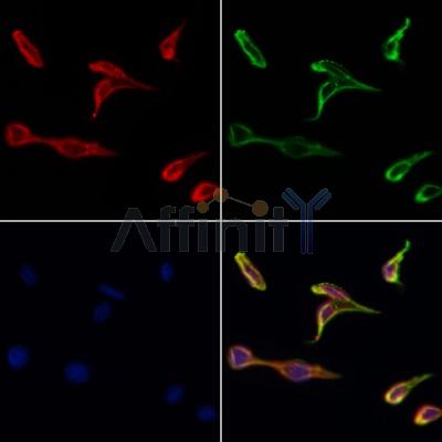 RNF6 Antibody - DF8890 staining Hela cells by IF/ICC.