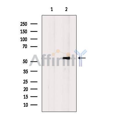 ANXA11 Antibody - Western blot analysis of extracts from HepG2 cells, using ANXA11 Antibody.