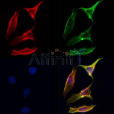 AQP11 Antibody - DF9222 staining Hela cells by IF/ICC.