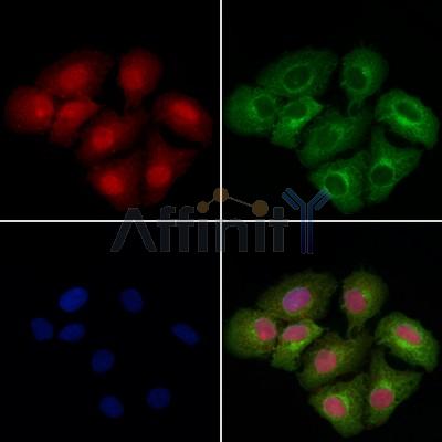 DYNLT3 Antibody - DF9474 staining Hela cells by IF/ICC.