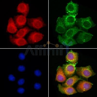 DFNA5/GSDME Antibody - DF9705 staining HepG2 cells by IF/ICC.