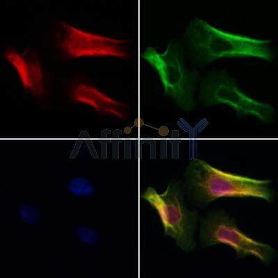 SYT8 Antibody - DF9955 staining Hela cells by IF/ICC.