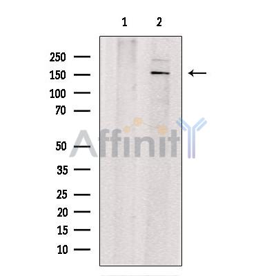 GASP1 Antibody - Western blot analysis of extracts from MDA-MB231, using GASP1 Antibody.