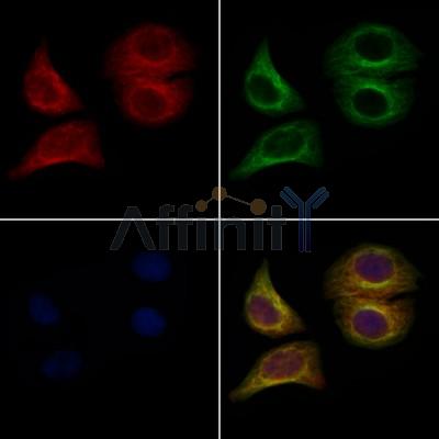 TGF beta 1 Antibody - AF1027 staining Hela cells by IF/ICC.