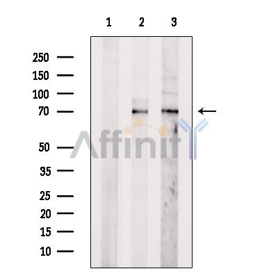 N-WASP Antibody - Western blot analysis of extracts from various samples, using N-WASP Antibody.