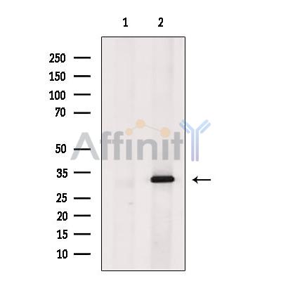 CDK20 Antibody - Western blot analysis of extracts from Mouse  heart, using CDK20 Antibody.