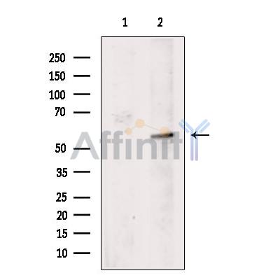 SLC16A1 Antibody - Western blot analysis of extracts from A2780 cells, using SLC16A1 Antibody.