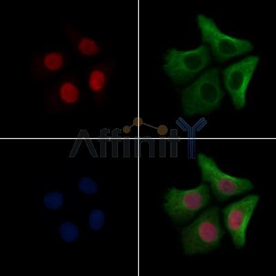 CUL4B Antibody - AF7583 staining Hela cells by IF/ICC.